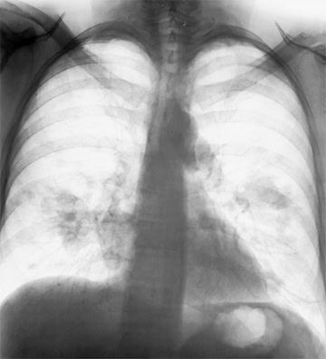 ASUS HA3281A Monitör H14