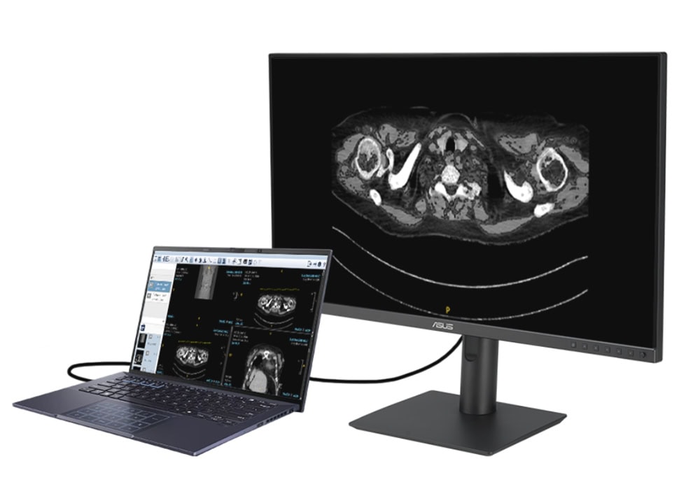 asus-mh2441a-23-8-inc-5ms-2k-qhd-ips-pivot-monitor