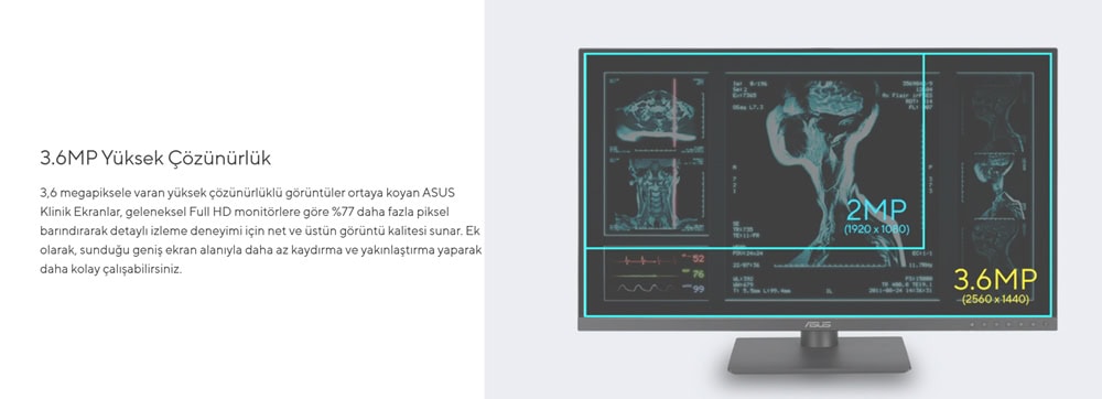 asus-mh2441a-23-8-inc-5ms-2k-qhd-ips-pivot-monitor